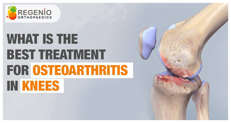 Best-Treatment-for-Osteoarthritis-for-knees-regenio