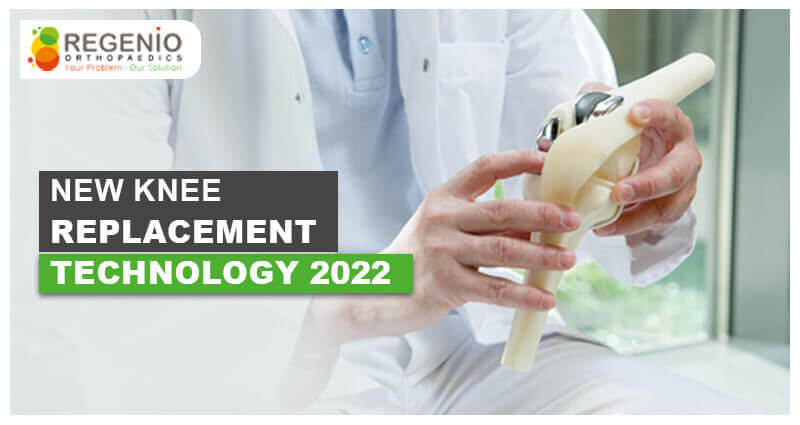 New Knee Replacement Technology 2022