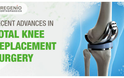 Recent Advances in Total Knee Replacement Surgery