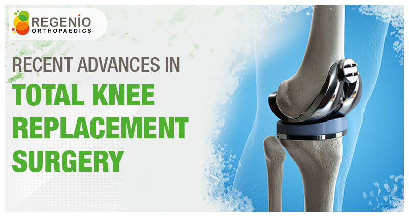 Recent-Advances-in-total-knee-replacment-surgery-Regenio-1