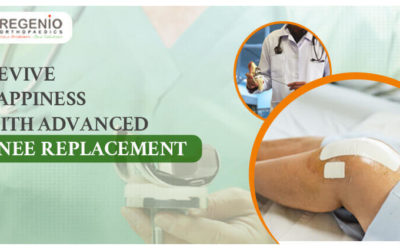 Revive Happiness with Advanced Knee Replacement