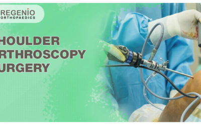 Shoulder Arthroscopy Surgery Cost