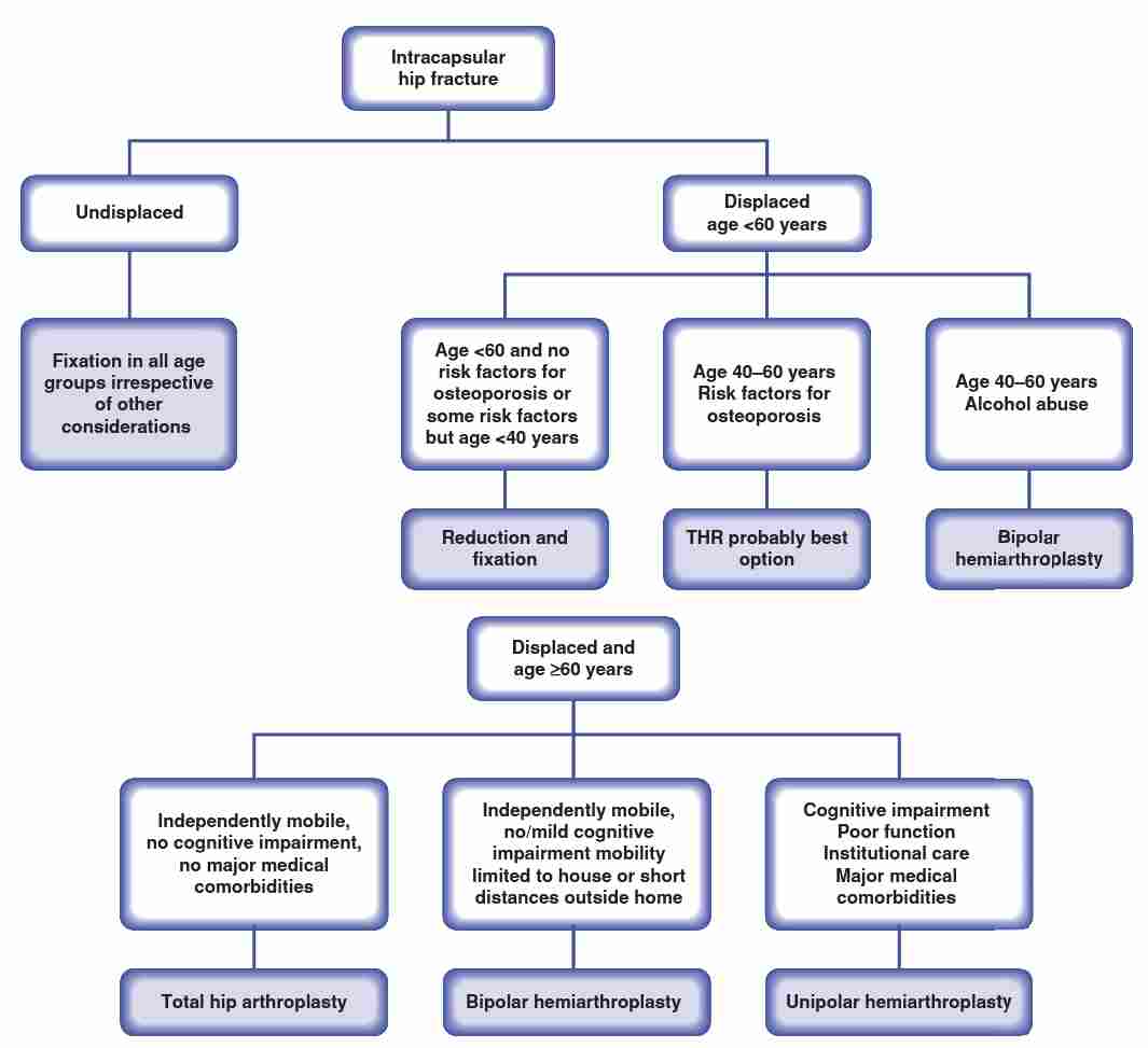 Treatment for Hip Fractures in Adults- this algorithm is followed for treatment of hip fractures in elderly.