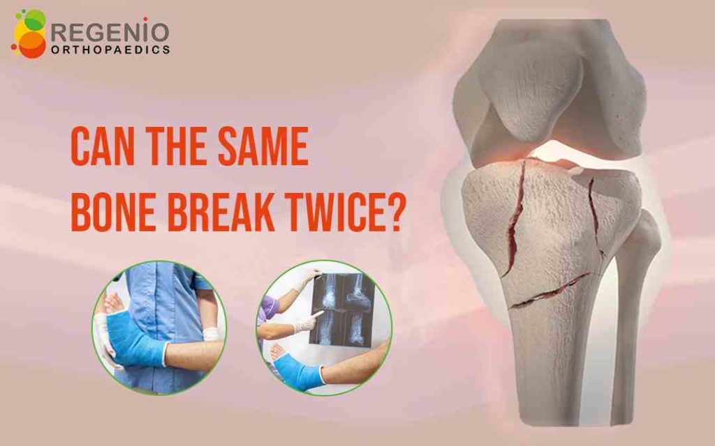 Can The Same Bone Break Twice?