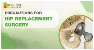 Precautions After Hip Replacement Surgery