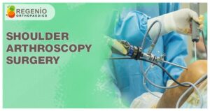 Shoulder Arthroscopy Cost