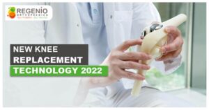 New Knee Replacement Technology