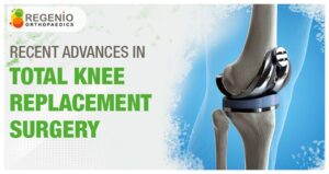 Latest Advances in Total Knee Replacement Surgery