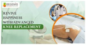 Advanced Knee Replacement