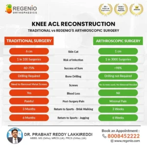 Knee ACL Reconstruction