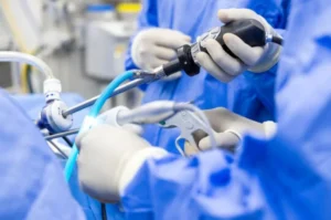 Arthroscopic Bankart Repair