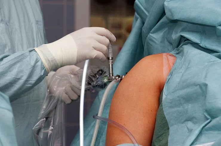Shoulder Arthroscopy